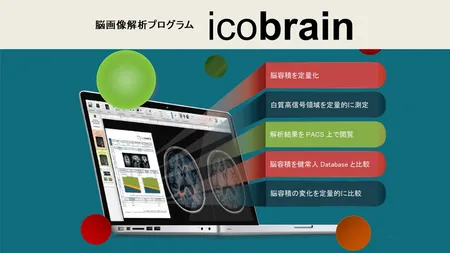 脳画像解析プログラム icobrain