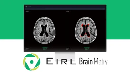 EIRL Brain Metry