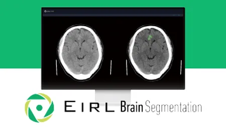 EIRL Brain Segmentation