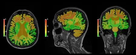 AI-Rad Companion Brain MR