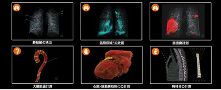 AI-Rad Companion Chest CT