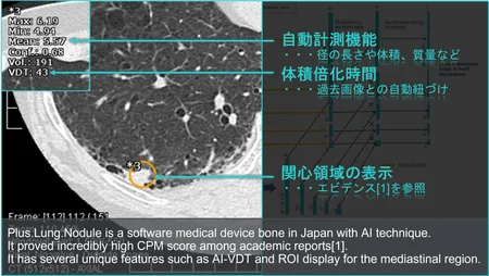 Plus.Lung.Nodule (CT-AI)