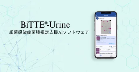 細菌感染症菌種推定支援AIソフトウェアBiTTE<sup>®</sup>-Urine